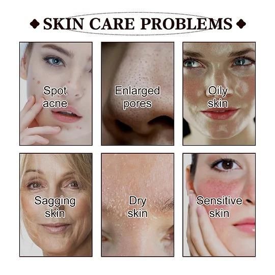 Black Tea Face Mask 100g Pack of 1Black Tea Face Mask – Anti-Acne, Anti-Spot & Blackhead Remover | 100g | Pack of 1