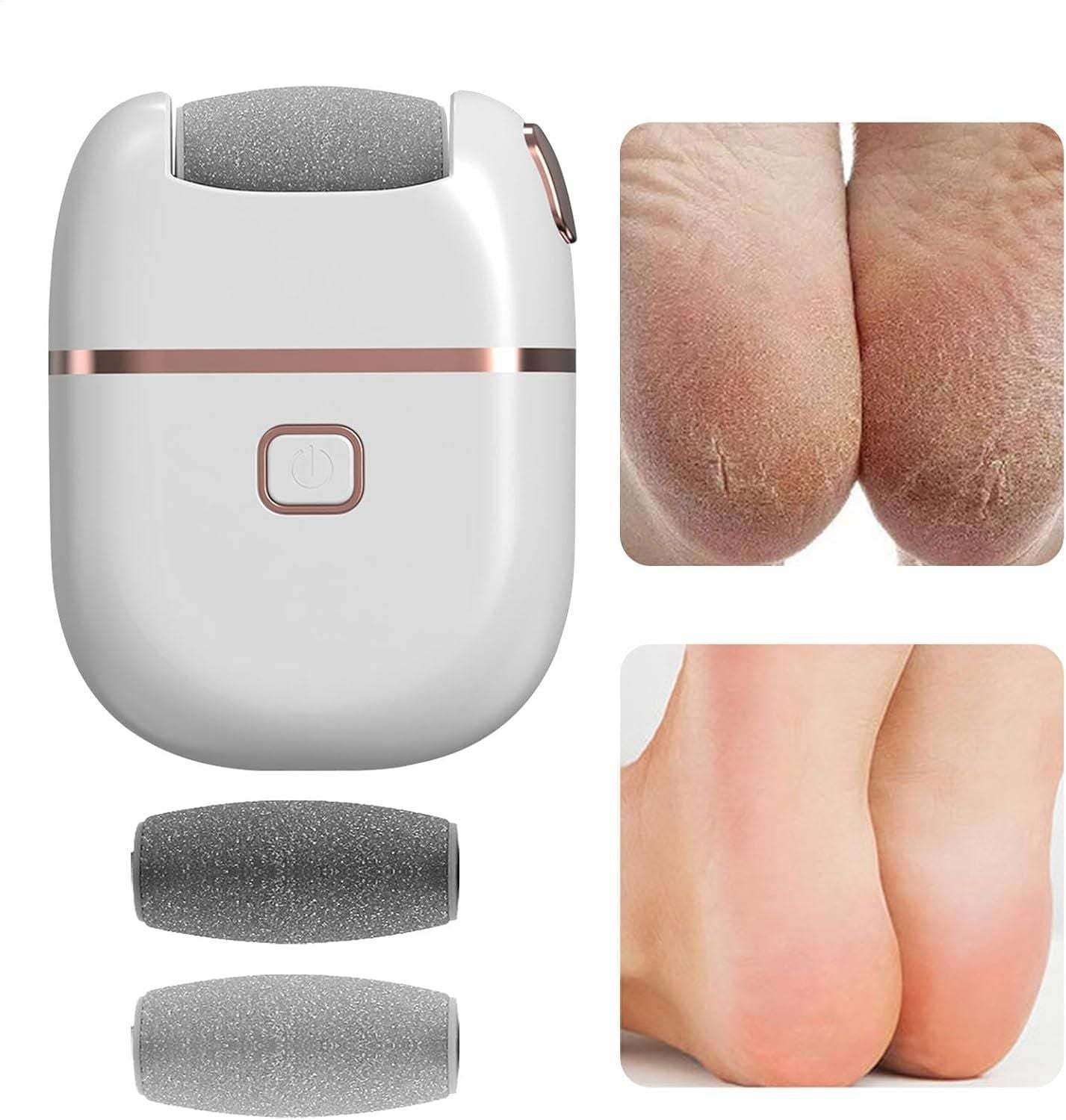Electronic Pedicure Tool – Electric Callus Remover for Smooth, Soft Feet | Gentle Foot Care at Home