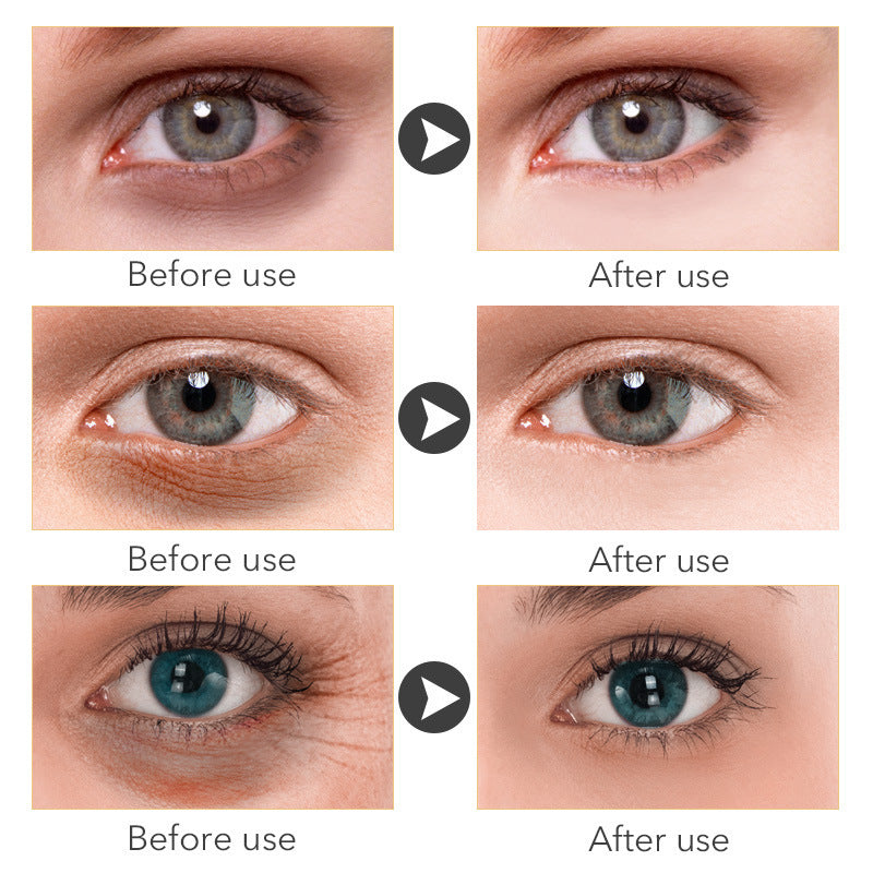 Beauty Eye Cream 30ml – Rejuvenate Tired Eyes with Deep Hydration