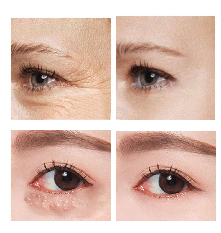 Beauty Eye Cream 30ml – Rejuvenate Tired Eyes with Deep Hydration